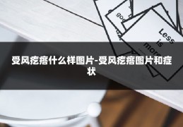 受风疙瘩什么样图片-受风疙瘩图片和症状