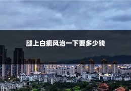 腿上白癜风治一下要多少钱