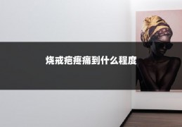 烧戒疤疼痛到什么程度