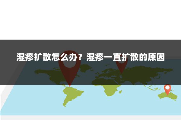 湿疹扩散怎么办？湿疹一直扩散的原因