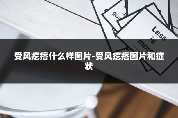 受风疙瘩什么样图片-受风疙瘩图片和症状